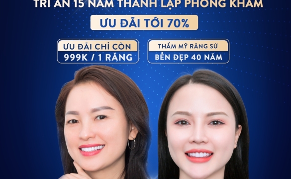 TRÁM RĂNG BẰNG COMPOSITE CÓ TỐT KHÔNG?